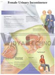 Female Urinary Incontinence - Anatomical Chart